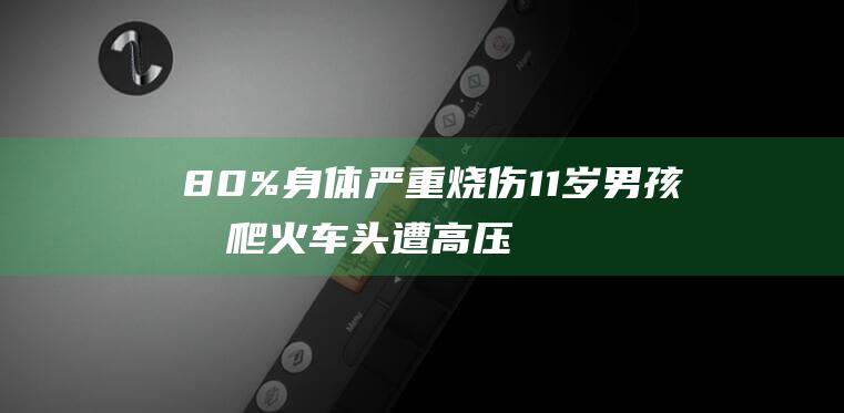 80%身体严重烧伤 11岁男孩攀爬火车头遭高压电击 (80岁身体素质)